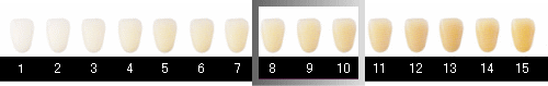 歯の色レベルチェック（シェードテイキング）